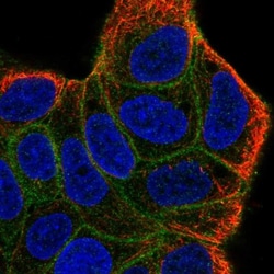 HM74A/PUMA-G/GPR109A/NIACR1 Antibody, Novus Biologicals 0.1mL; Unlabeled:Antibodies,